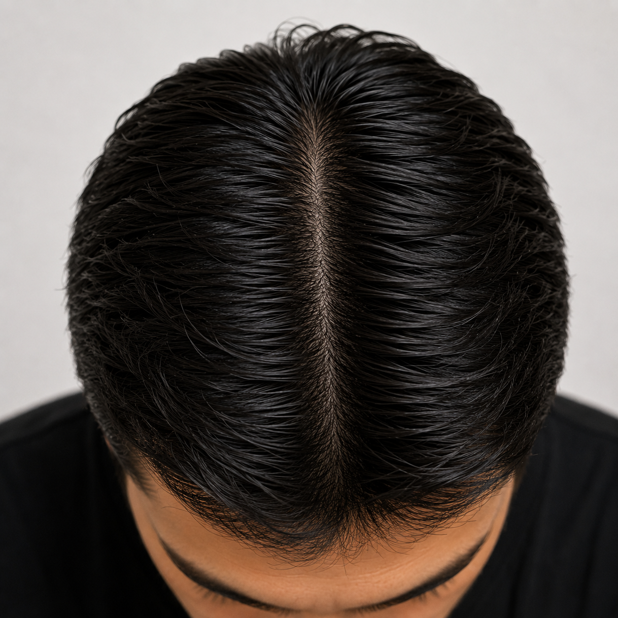 Men’s Hair Transformation - Before