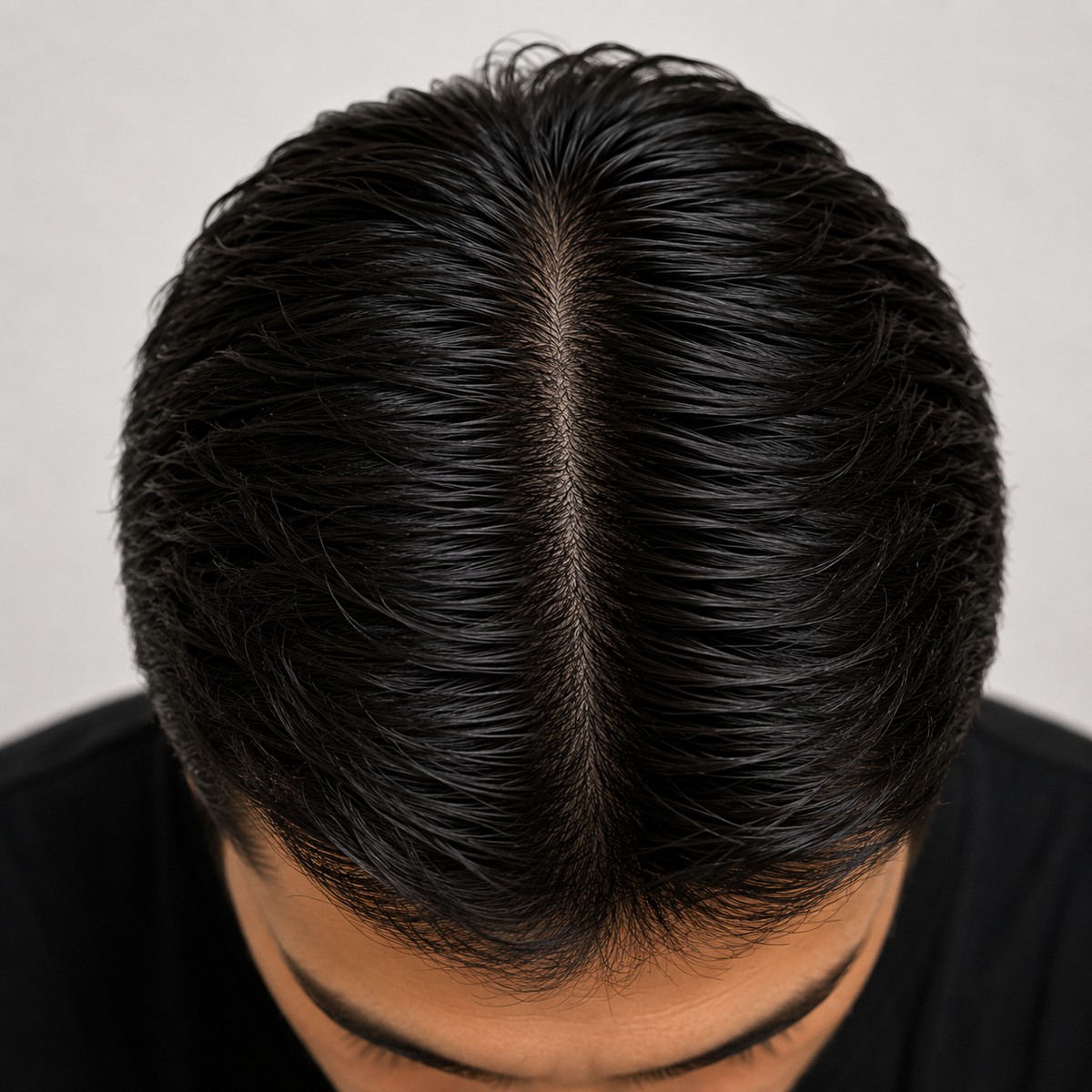 Men’s Hair Transformation - Before